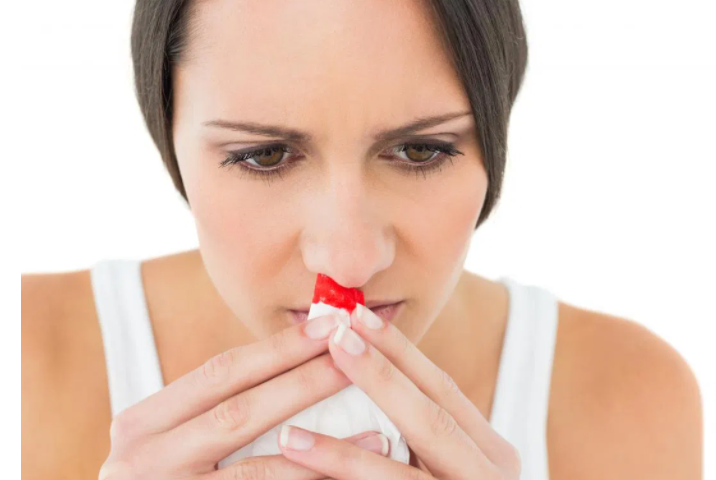 When Should You Be Worried About Nosebleeds?