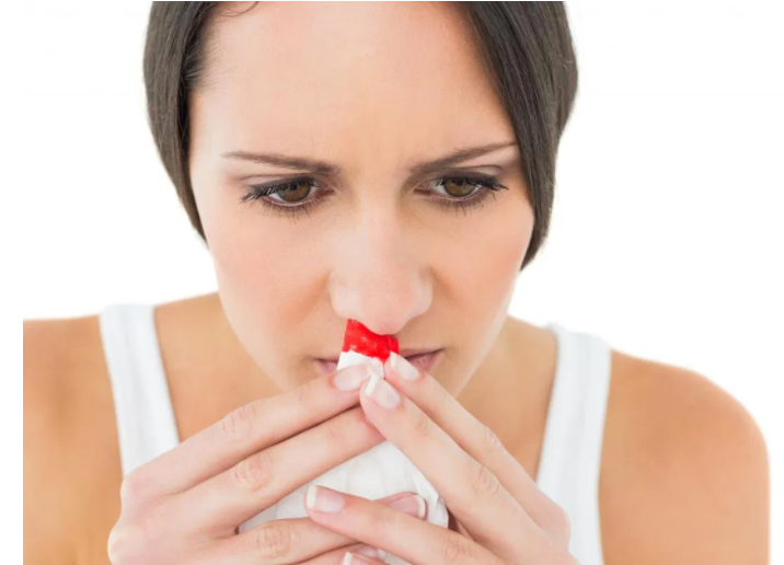 When Should You Be Worried About Nosebleeds?